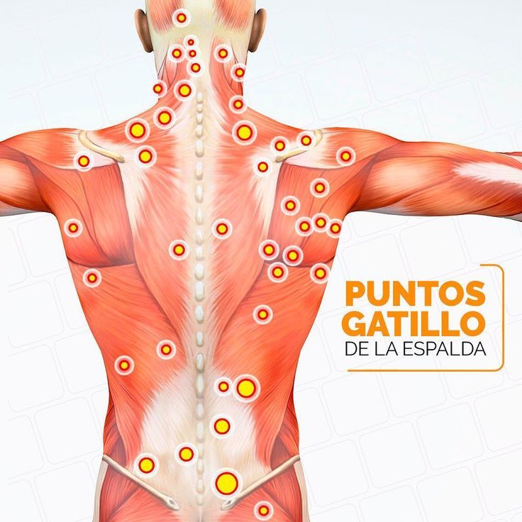 Pung Gatillo Control de Imagen en República Dominicana
